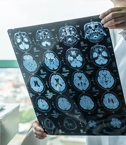 brain-injuries