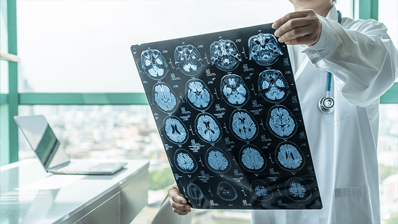 brain-injuries